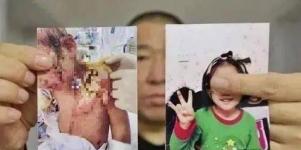 抚顺6岁女童惨遭虐待：为人父母不用考试，有多可怕？